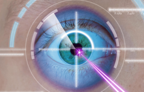 מה חשוב שתדעו על ניתוח לייזר בעיניים